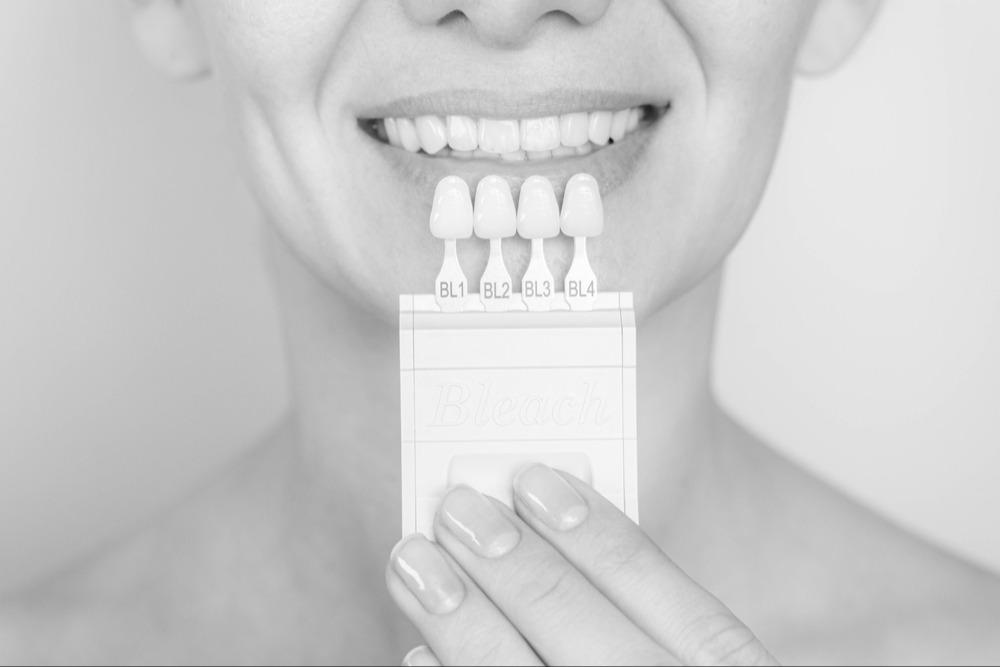 Enhancing Smiles with Veneers